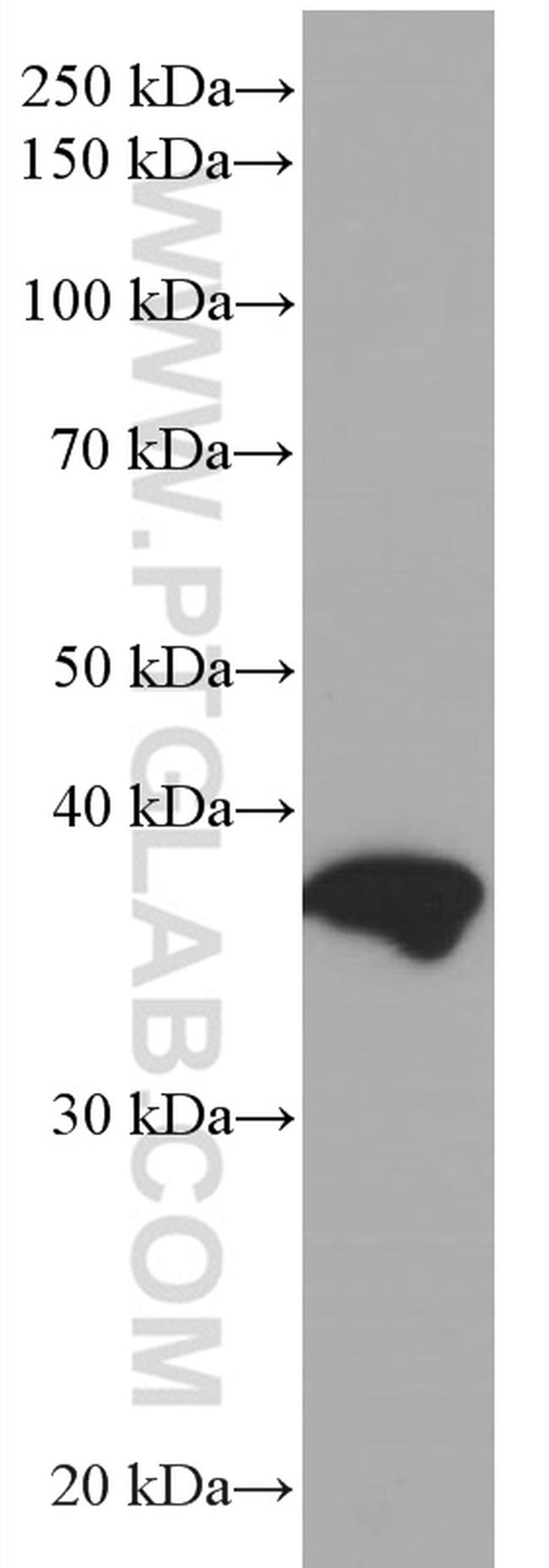 TMEM173/STING Antibody in Western Blot (WB)