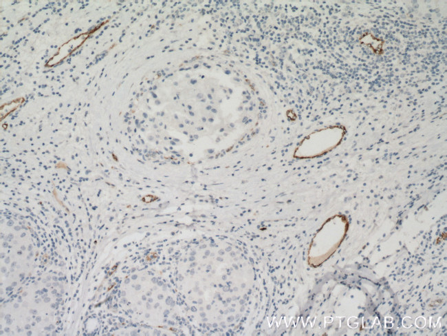 vwf Antibody in Immunohistochemistry (Paraffin) (IHC (P))