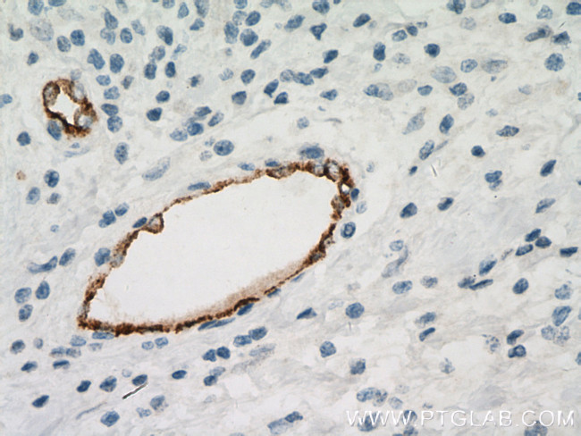 vwf Antibody in Immunohistochemistry (Paraffin) (IHC (P))