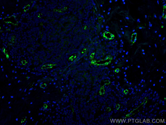 vwf Antibody in Immunohistochemistry (PFA fixed) (IHC (PFA))