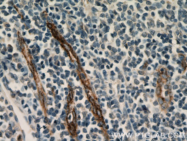 vwf Antibody in Immunohistochemistry (Paraffin) (IHC (P))