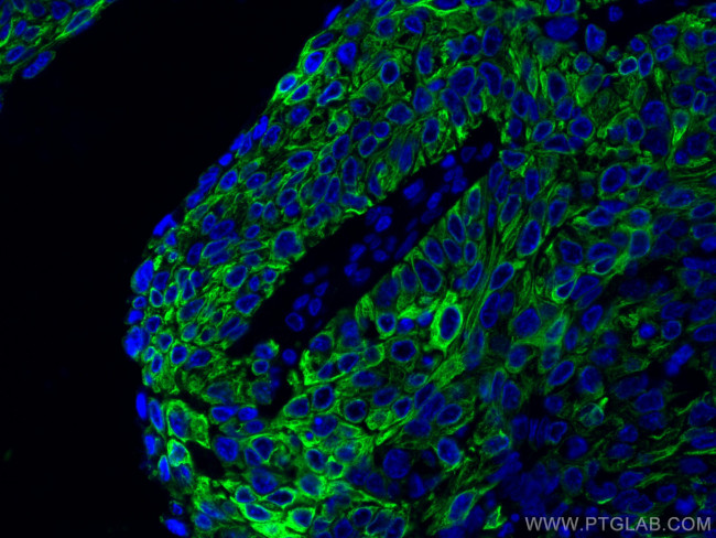 Cytokeratin 13 Antibody in Immunohistochemistry (PFA fixed) (IHC (PFA))