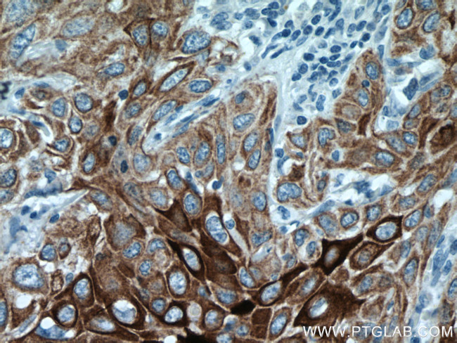 Cytokeratin 13 Antibody in Immunohistochemistry (Paraffin) (IHC (P))