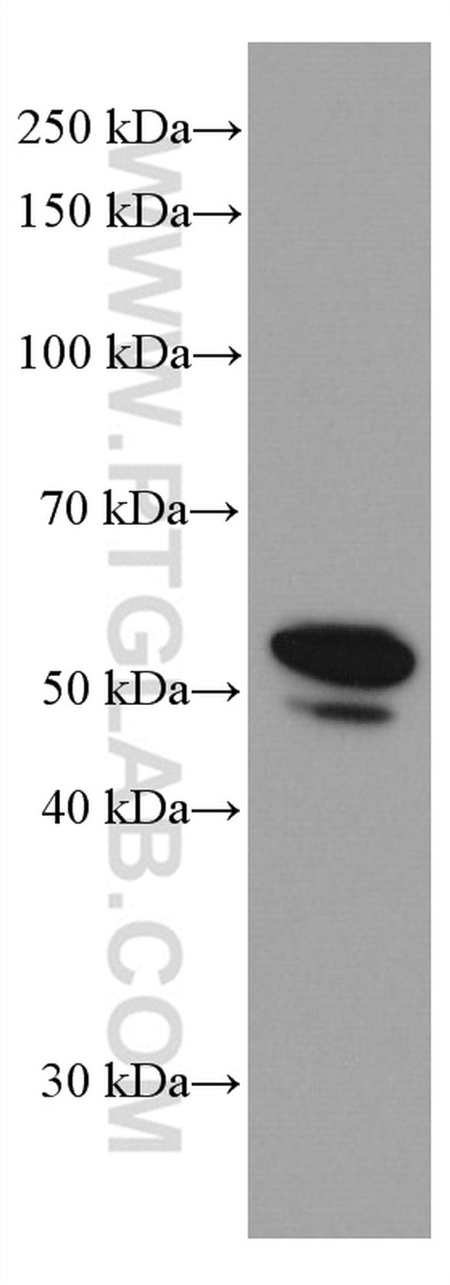 Cytokeratin 13 Antibody in Western Blot (WB)