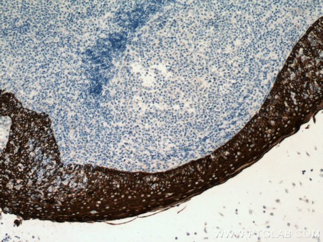 Cytokeratin 13 Antibody in Immunohistochemistry (Paraffin) (IHC (P))