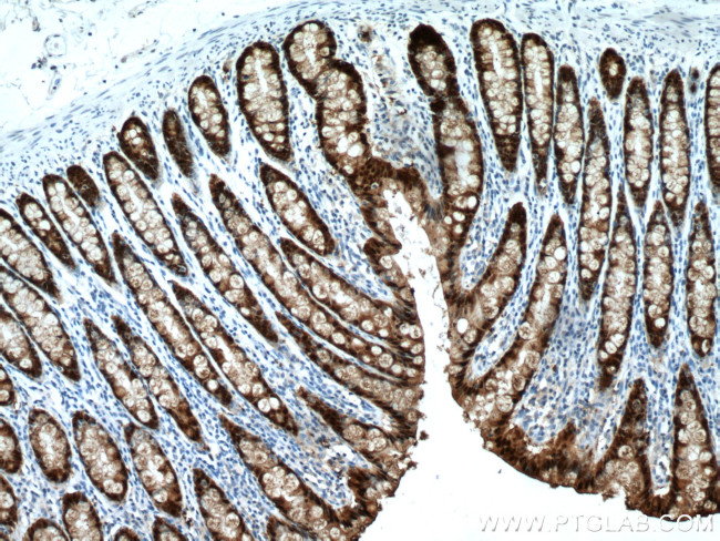 Galectin-4 Antibody in Immunohistochemistry (Paraffin) (IHC (P))