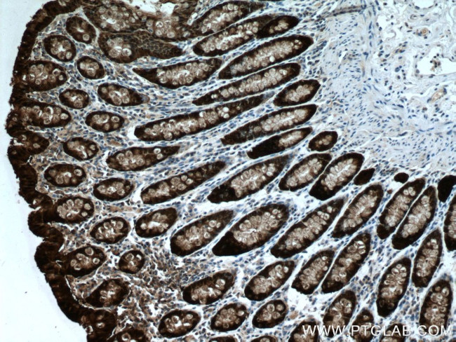 Galectin-4 Antibody in Immunohistochemistry (Paraffin) (IHC (P))