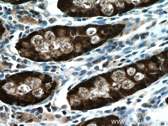 Galectin-4 Antibody in Immunohistochemistry (Paraffin) (IHC (P))