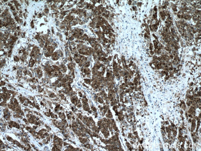 Galectin-4 Antibody in Immunohistochemistry (Paraffin) (IHC (P))