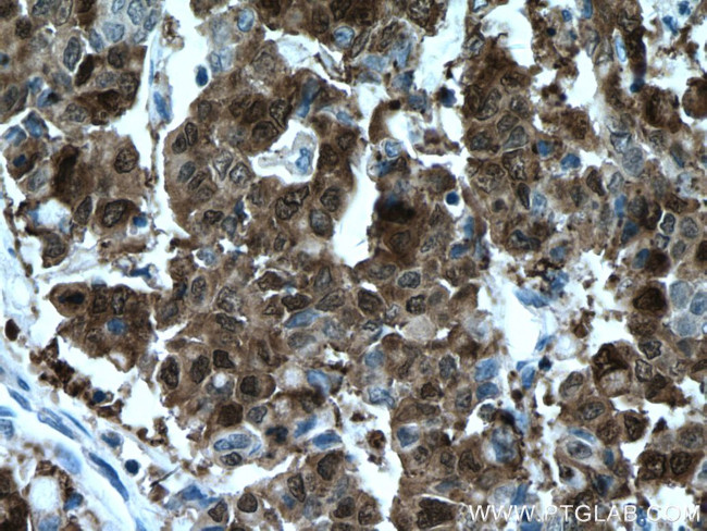 Galectin-4 Antibody in Immunohistochemistry (Paraffin) (IHC (P))