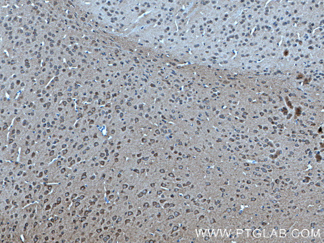 NRBP2 Antibody in Immunohistochemistry (Paraffin) (IHC (P))