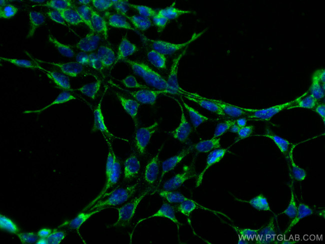 RAB3GAP1 Antibody in Immunocytochemistry (ICC/IF)