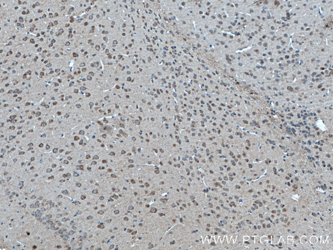 RAB3GAP1 Antibody in Immunohistochemistry (Paraffin) (IHC (P))