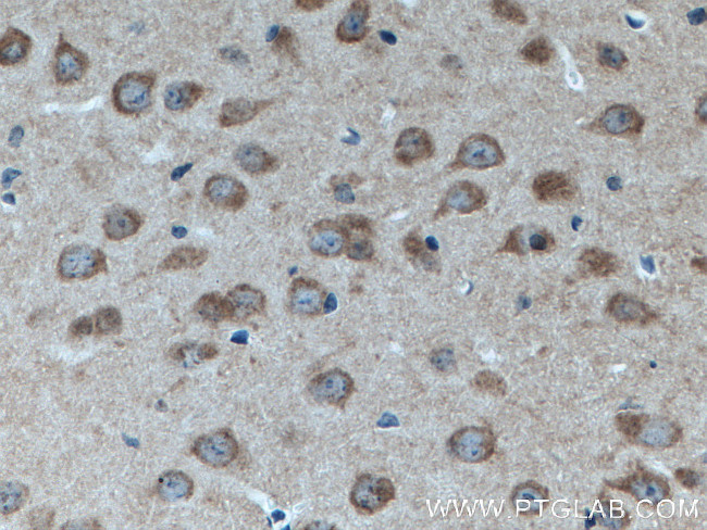 RAB3GAP1 Antibody in Immunohistochemistry (Paraffin) (IHC (P))