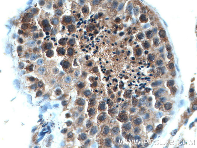 RAB3GAP1 Antibody in Immunohistochemistry (Paraffin) (IHC (P))