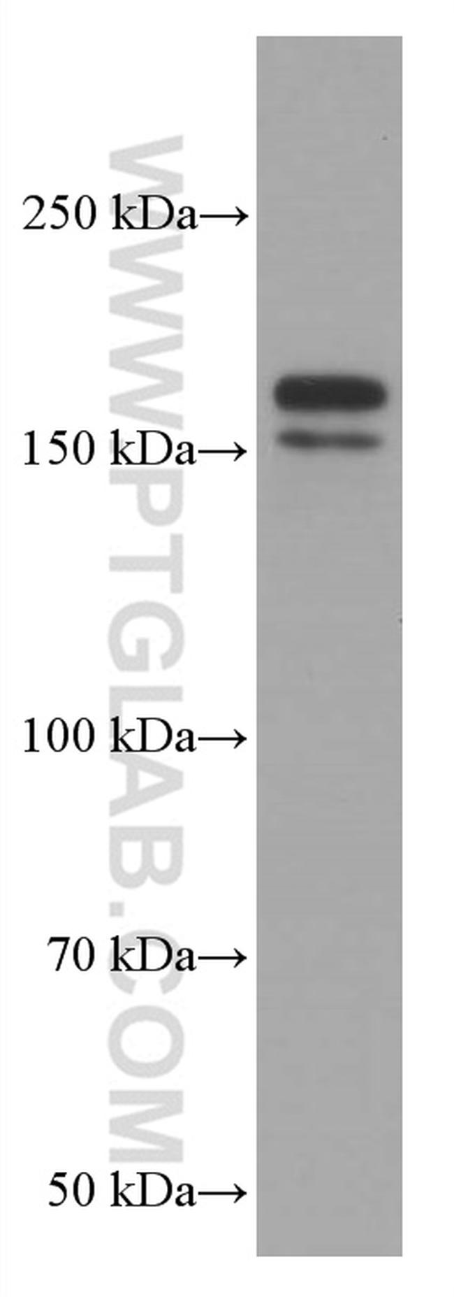 EHMT2 Antibody in Western Blot (WB)