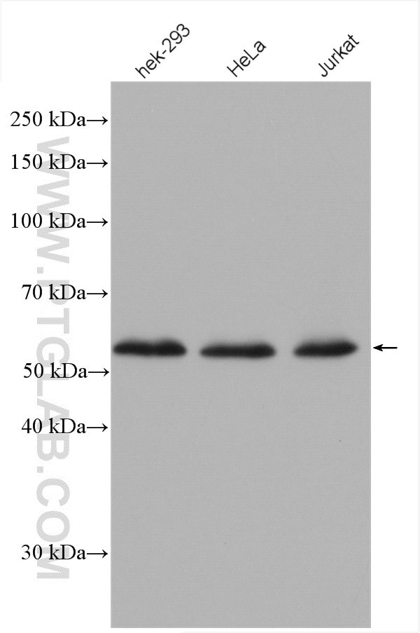 FKBP8 Antibody in Western Blot (WB)