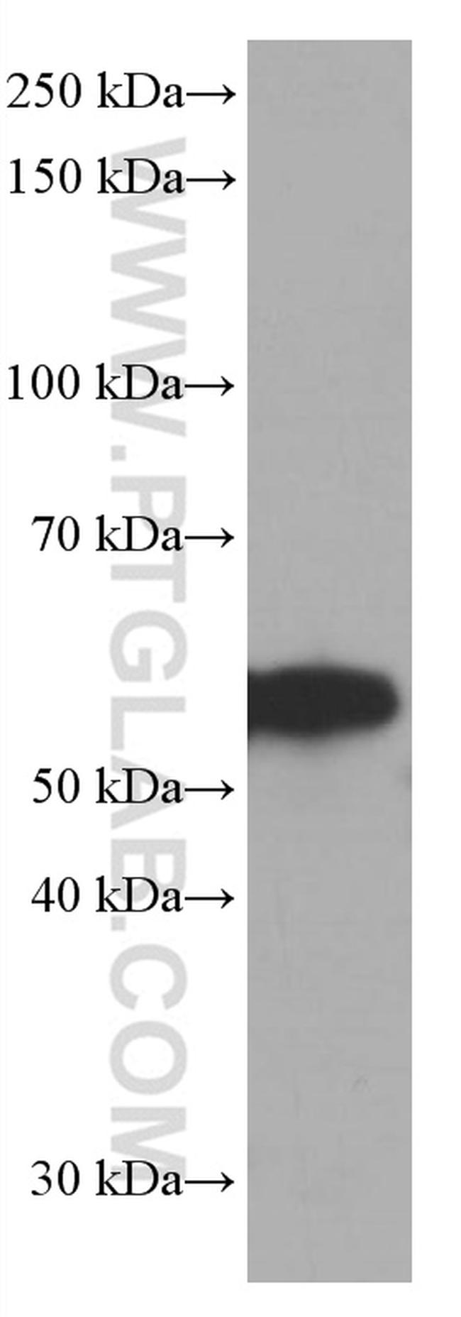 FKBP8 Antibody in Western Blot (WB)