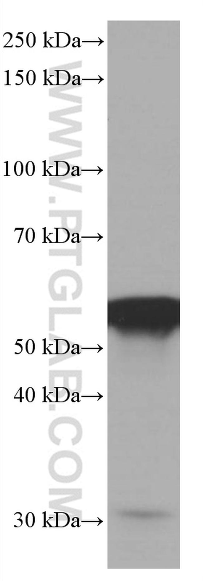 FKBP8 Antibody in Western Blot (WB)