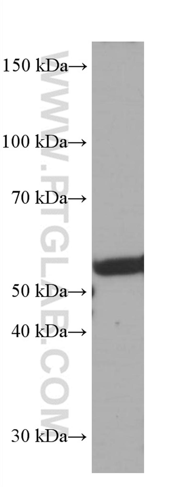 FKBP8 Antibody in Western Blot (WB)