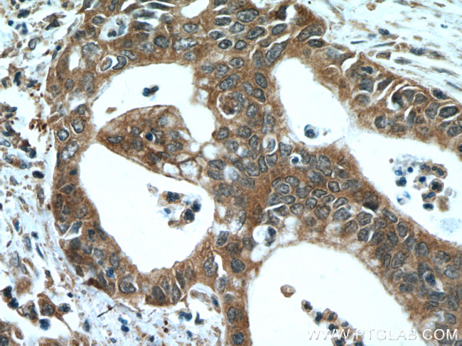 NEUROD1 Antibody in Immunohistochemistry (Paraffin) (IHC (P))