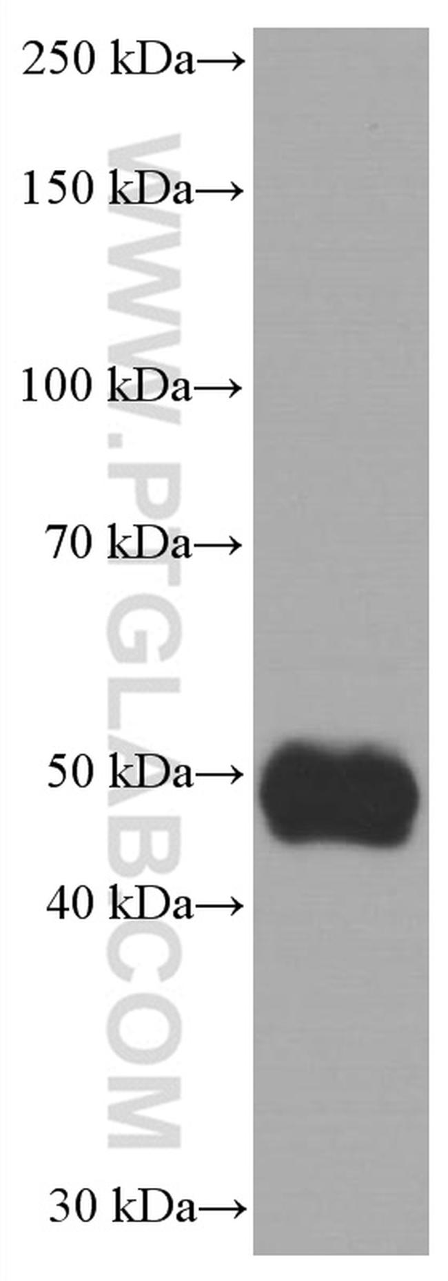 NEUROD1 Antibody in Western Blot (WB)