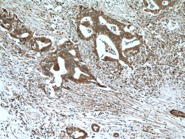 NEUROD1 Antibody in Immunohistochemistry (Paraffin) (IHC (P))