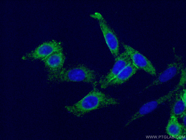 TNFAIP3 Antibody in Immunocytochemistry (ICC/IF)