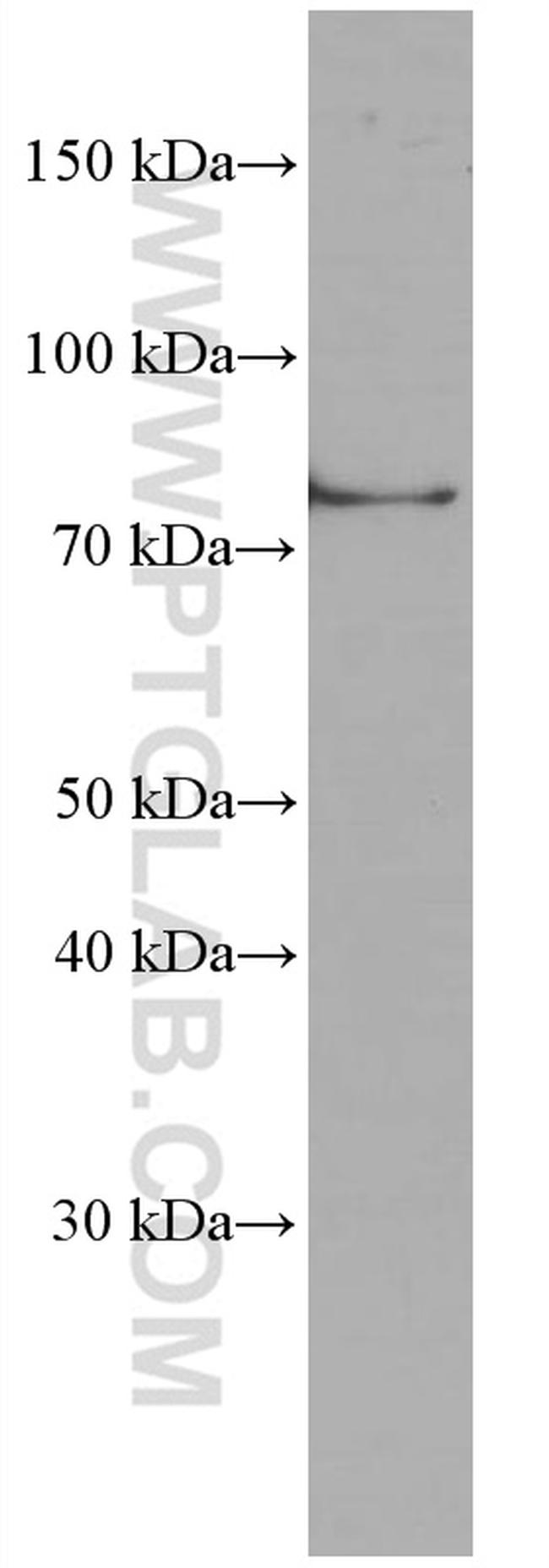 TNFAIP3 Antibody in Western Blot (WB)