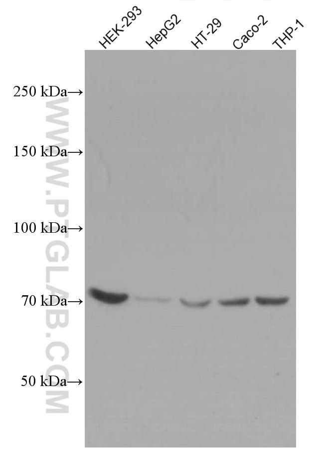 ABCD3 Antibody in Western Blot (WB)