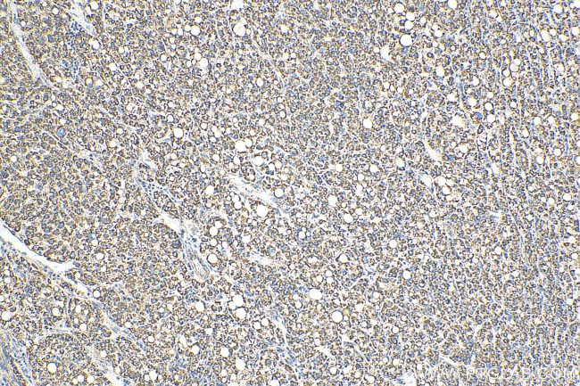 OCIAD1 Antibody in Immunohistochemistry (Paraffin) (IHC (P))