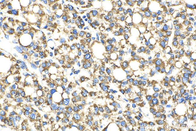 OCIAD1 Antibody in Immunohistochemistry (Paraffin) (IHC (P))