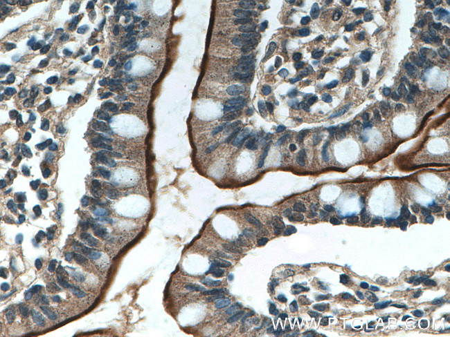 ACE2 Antibody in Immunohistochemistry (Paraffin) (IHC (P))