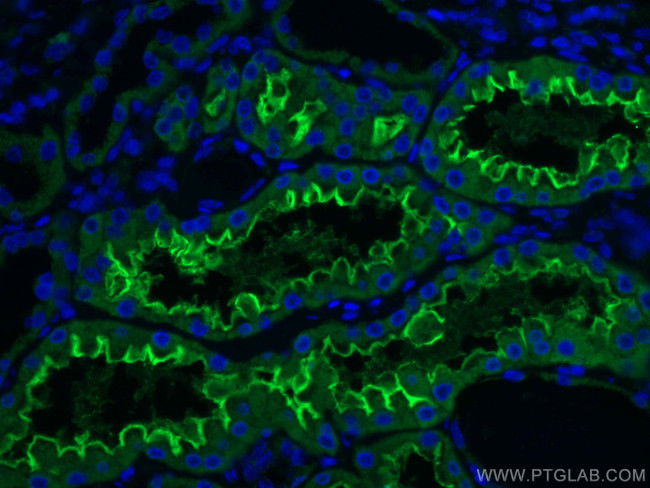 ACE2 Antibody in Immunohistochemistry (PFA fixed) (IHC (PFA))