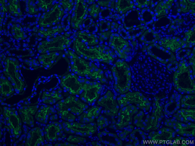 ACE2 Antibody in Immunohistochemistry (PFA fixed) (IHC (PFA))