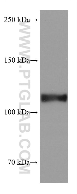 ACE2 Antibody in Western Blot (WB)