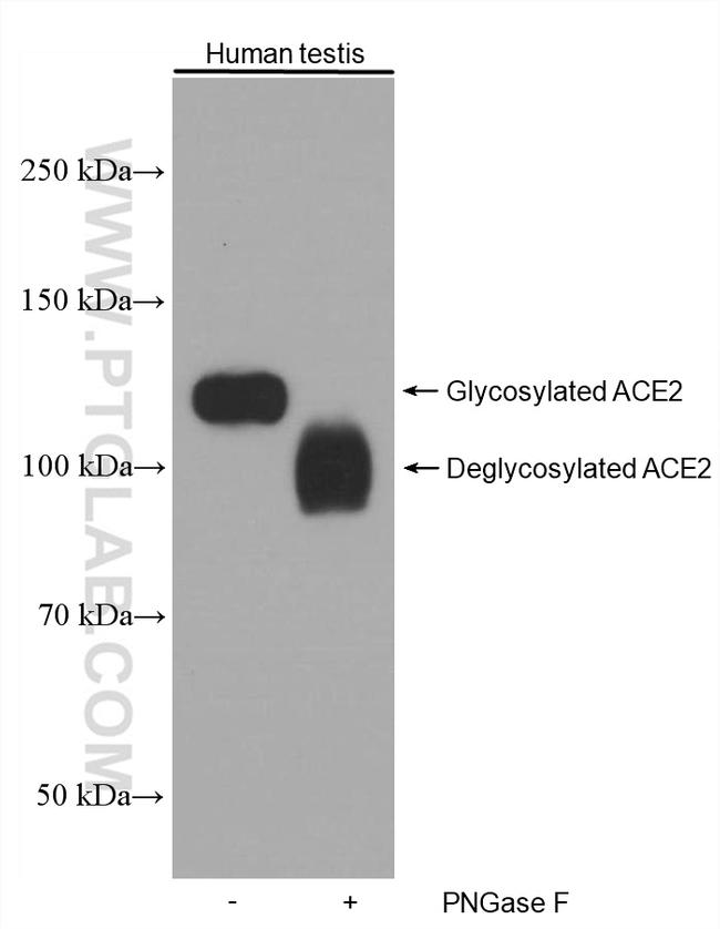 ACE2 Antibody in Western Blot (WB)