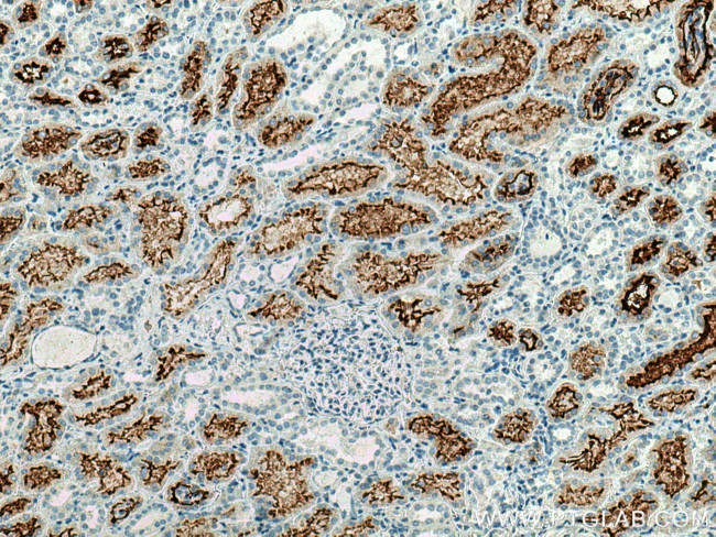 ACE2 Antibody in Immunohistochemistry (Paraffin) (IHC (P))