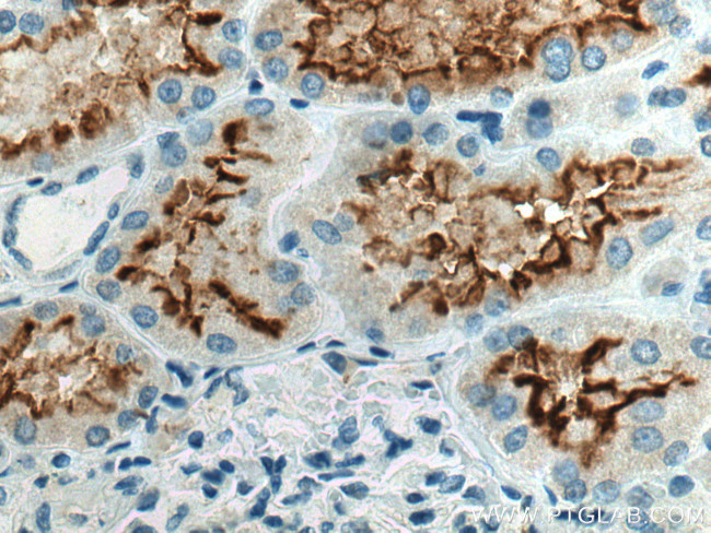 ACE2 Antibody in Immunohistochemistry (Paraffin) (IHC (P))