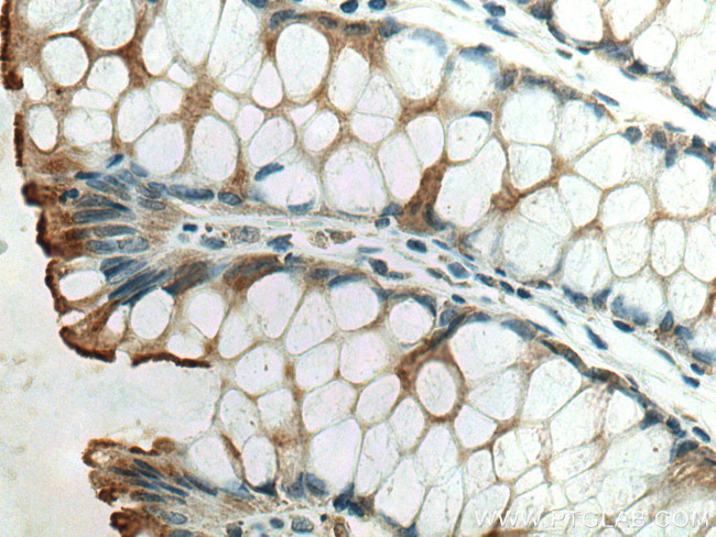 ACE2 Antibody in Immunohistochemistry (Paraffin) (IHC (P))