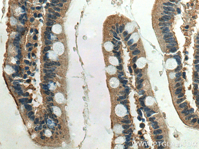 ACE2 Antibody in Immunohistochemistry (Paraffin) (IHC (P))