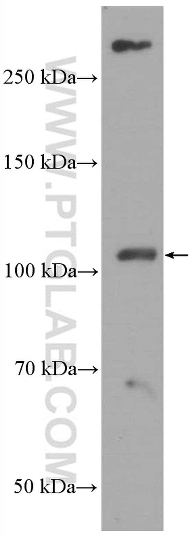 ACE2 Antibody in Western Blot (WB)