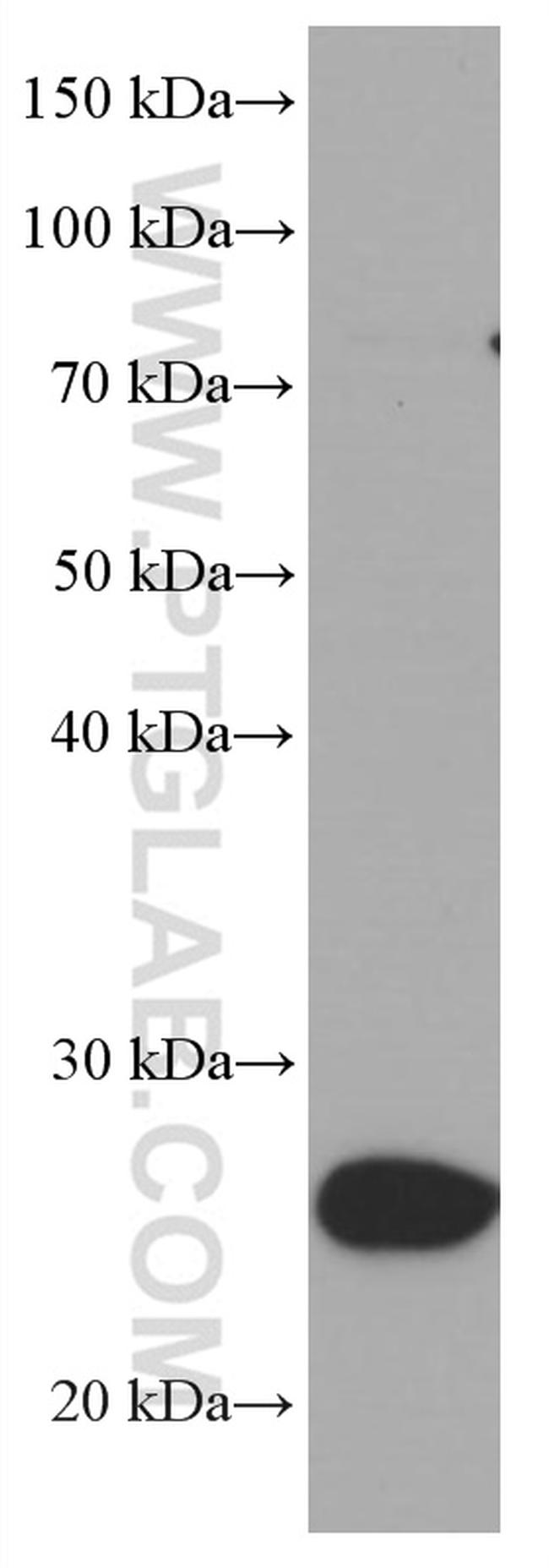 UCP2 Antibody in Western Blot (WB)