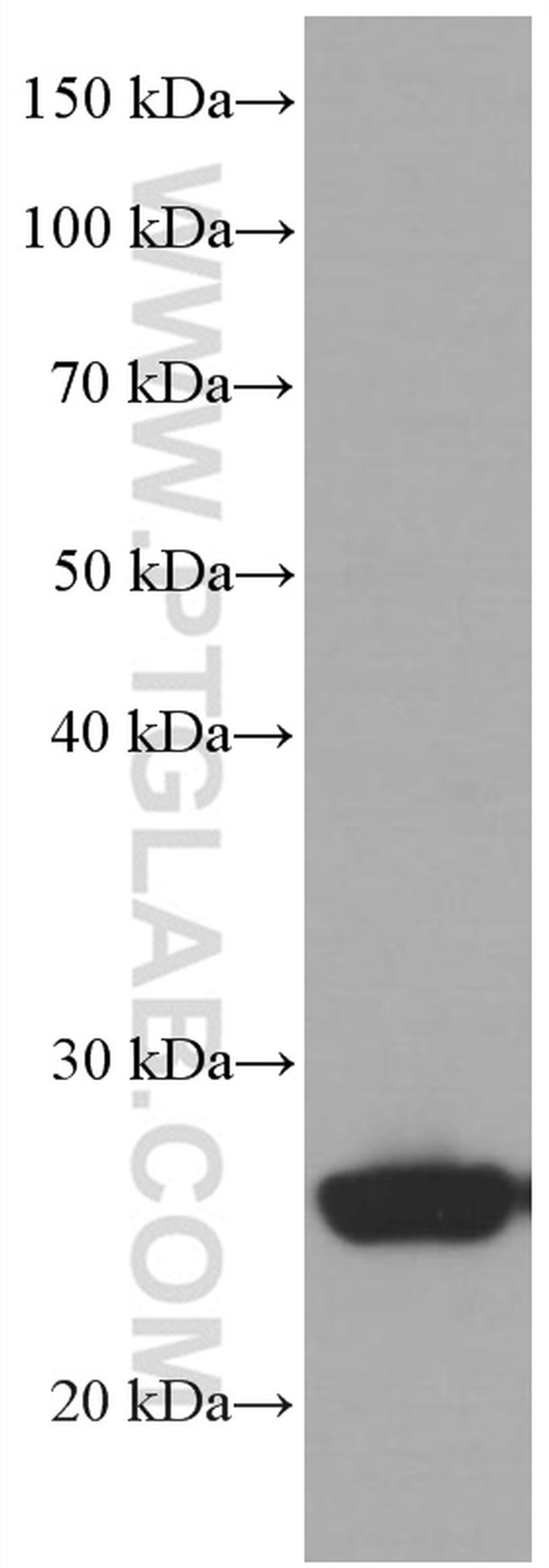 UCP2 Antibody in Western Blot (WB)