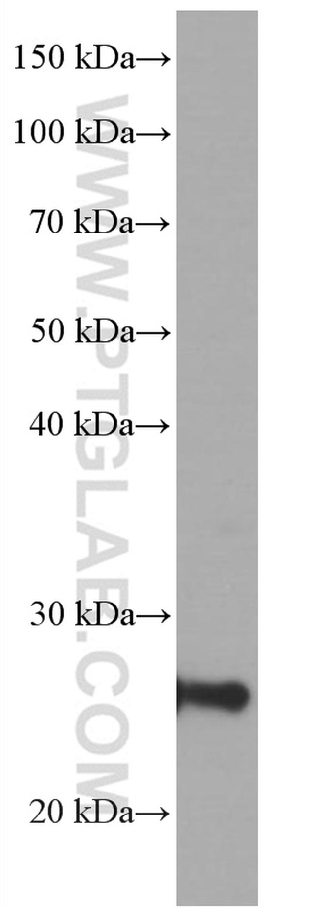 UCP2 Antibody in Western Blot (WB)