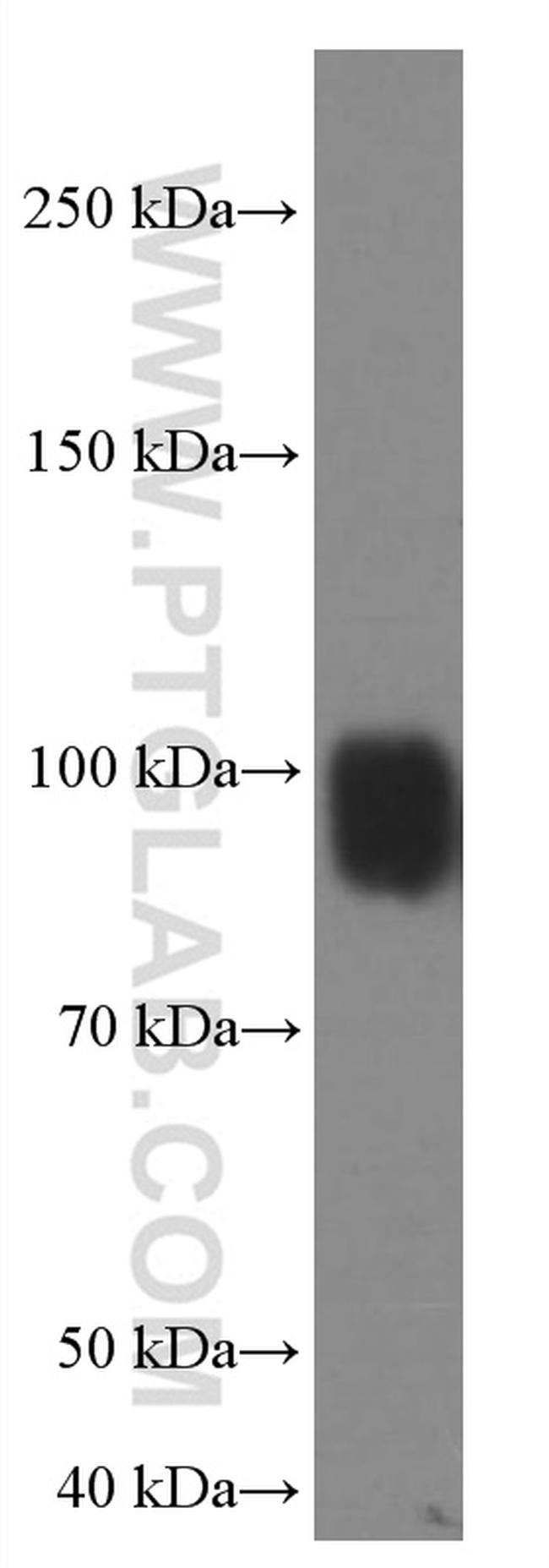 IFNGR1 Antibody in Western Blot (WB)