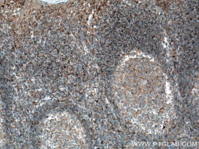 IFNGR1 Antibody in Immunohistochemistry (Paraffin) (IHC (P))