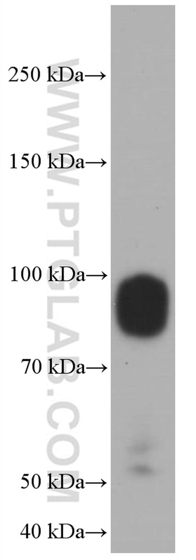 IFNGR1 Antibody in Western Blot (WB)