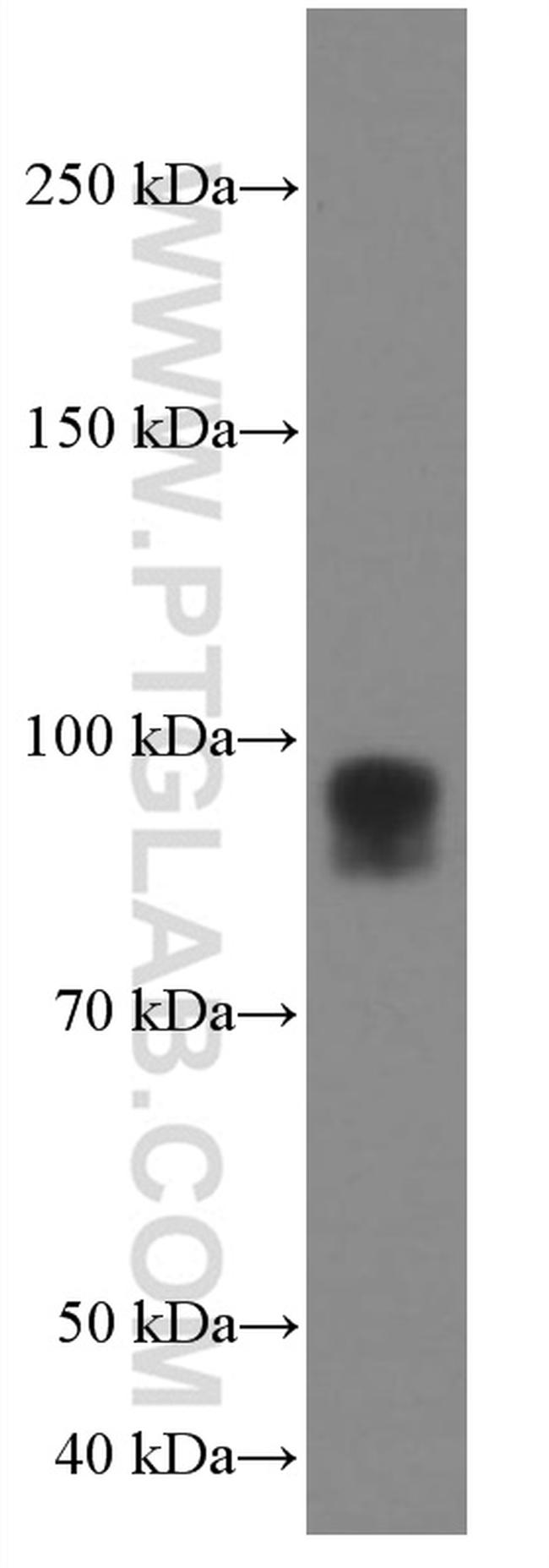 IFNGR1 Antibody in Western Blot (WB)