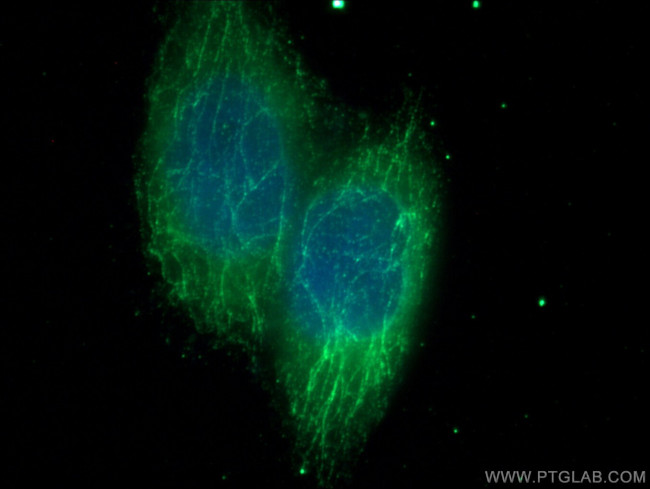 MTAP Antibody in Immunocytochemistry (ICC/IF)